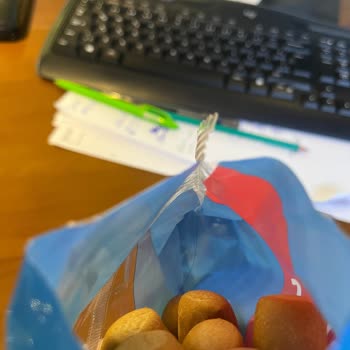 Aldığım Galetadan Kıl Çıkması Hijyen Ve Sağlık Endişesi Yarattı