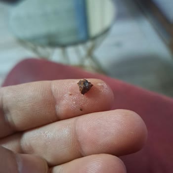 Sarma Lokumda Yoğun Kabuk Sorunu Ve Ulaşım Zorluğu