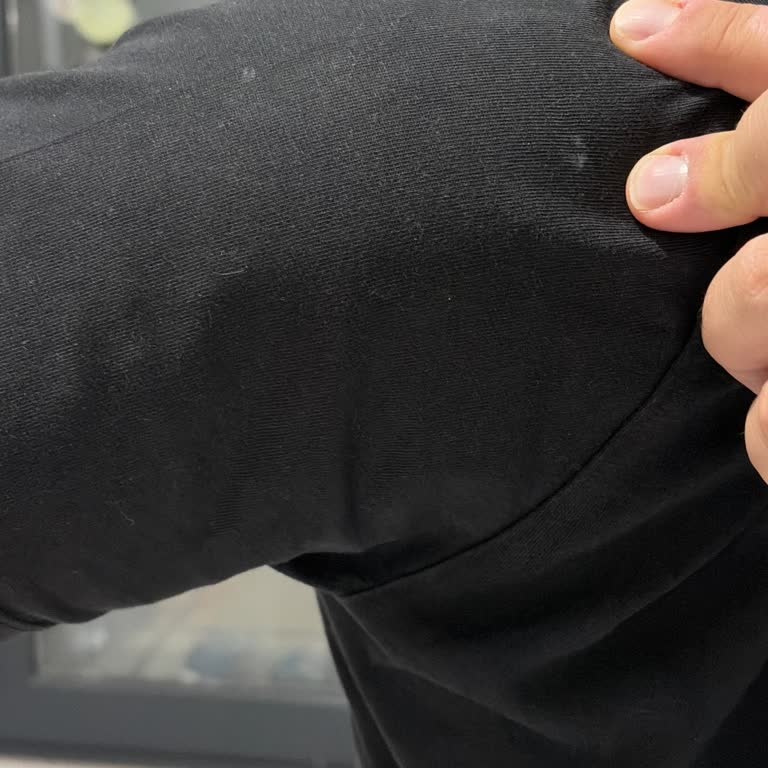 Philips Ütüm Sarı Su Damlatıyor Ve Çamaşırlarda Leke Bırakıyor