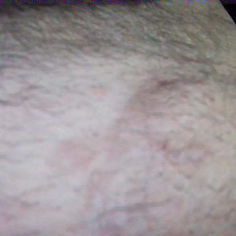 Ameliyat Sonrası Devam Eden Sağlık Sorunları Ve Doktorun İlgisizliği