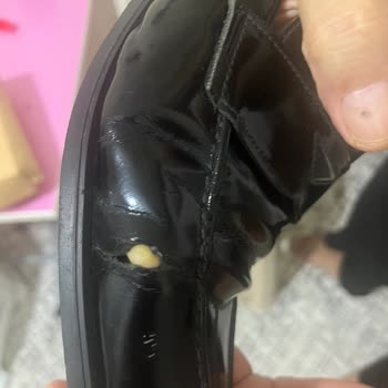 8 Ayda Bozulan Ayakkabım Kullanıcı Hatası Denilerek Reddedildi