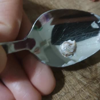 Eklerin İçinden Salyangoz Çıktı, Hijyen Ve İlgisizlik Şoku!