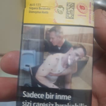 Sigaradan Odun Parçası Çıkıyor