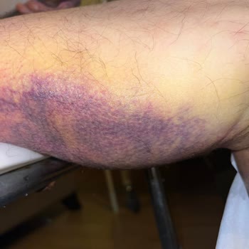 İstanbul Okan Üniversitesi Hastanesi'nde Bilgim Dışında Yapılan İşlemler Ve Ekstra Ücretler!