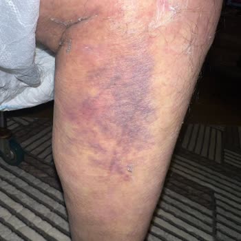 İstanbul Okan Üniversitesi Hastanesi'nde Bilgim Dışında Yapılan İşlemler Ve Ekstra Ücretler!