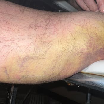 İstanbul Okan Üniversitesi Hastanesi'nde Bilgim Dışında Yapılan İşlemler Ve Ekstra Ücretler!