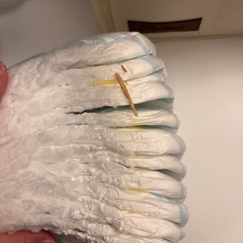 Molfix Bebek Bezinden Tahta Parçası Çıkması Ve Müşteri Hizmetlerinden Yanıtsız Kalma