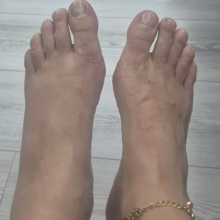 Aldığım Ayakkabının Sağlık Sorununa Yol Açması Ve Yetersiz Müşteri Hizmeti