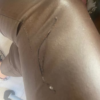 Pelin Şenoğlu Aldığım Pantolon İlk Kullanımda Soyuldu, Değişim Talebim Reddedildi