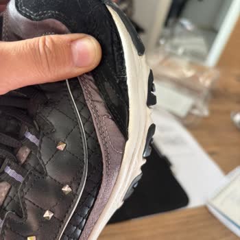 Skechers Ayakkabıda Erken Açılma Ve Garanti Kapsamında Destek Alamama