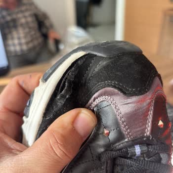 Skechers Ayakkabıda Erken Açılma Ve Garanti Kapsamında Destek Alamama