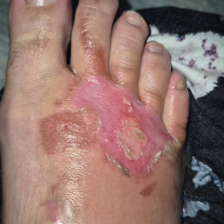 Teslimat Bilgisizliği Ve İletişim Sorunları Nedeniyle Mağduriyet