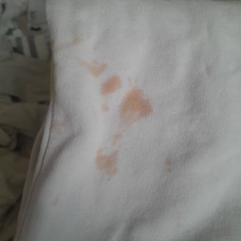 Beyaz Çamaşırlarda Pas Lekesi Sorunu Çözülmüyor, Makine Değişimi Talep Ediyorum