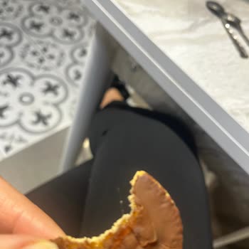 Aldığım Tatlıdan Kıl Çıkması Hijyen Endişesi Yarattı