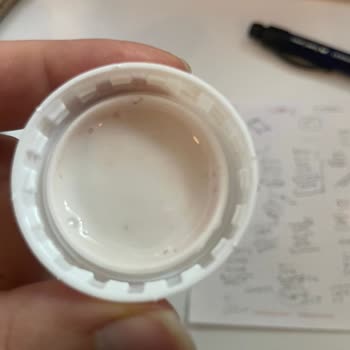 Kefir Şişesinin Kapağında Yabancı Maddeyle Karşılaştım, Hijyen Endişesi Yaşadım