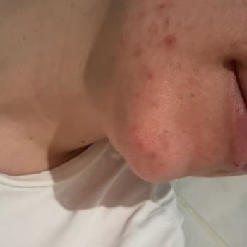 Leon Güzellik (Tokat) Paramın İadesini Yapmıyor ve İlgilenmiyor