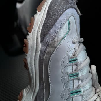 Skechers D'lites Ayakkabı Kısa Sürede Yırtıldı, Mağaza Sorumluluk Almadı