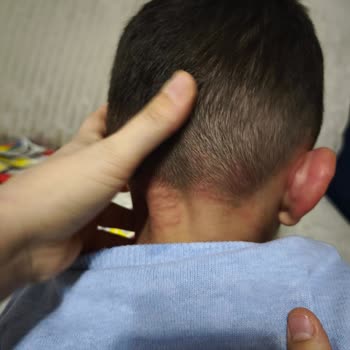 Cici Bebe Bisküvi Sonrası Çocuğumda Ciddi Alerjik Reaksiyon Gelişti