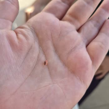 Torku Sucukta Hijyen Sorunu Ve Sağlık Riski Yaşadık