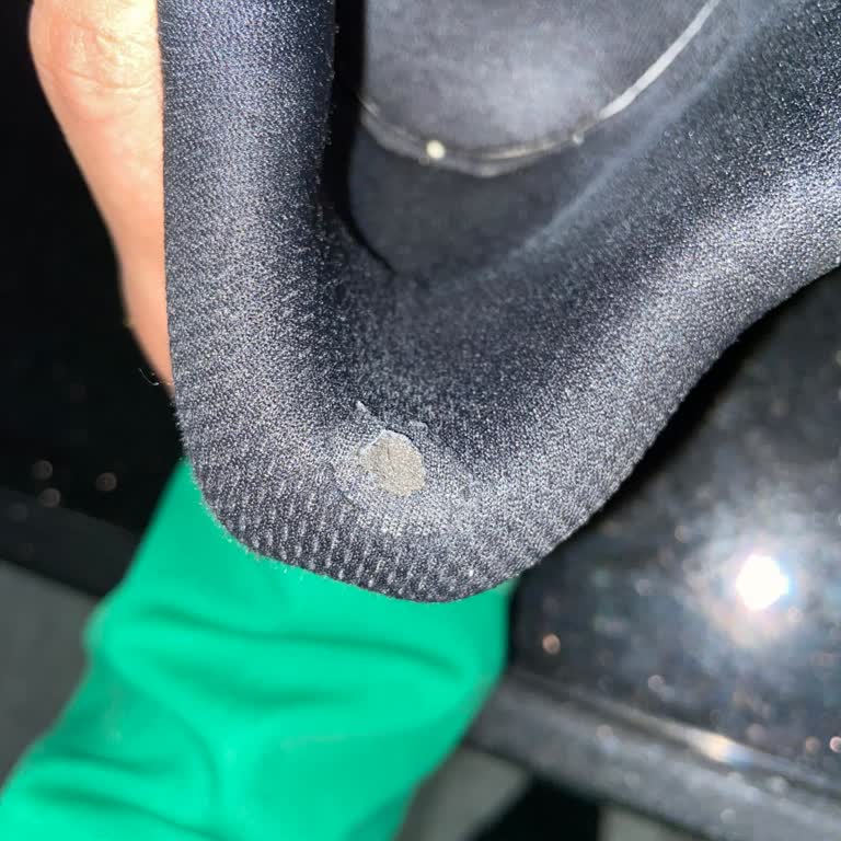 Kısa Sürede Deforme Olan Ayakkabıya Red Kararı Ve Çözüm Sunulmaması