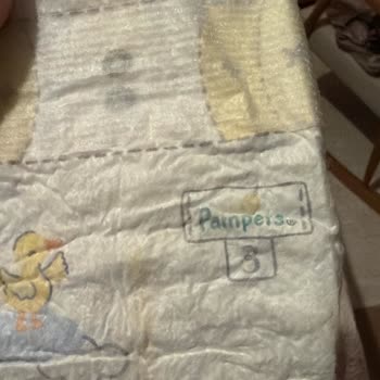 Prima Premium Care Bebek Bezi Pişik Yaptı Endişeliyim