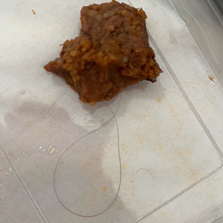 Ömer Aybak Adıyaman Çiğköftecisi Siparişten Saç Çıkması Nedeniyle Hijyen Ve İade Talebi