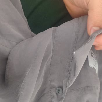 Paul Mark Gömleklerde Erken Deformasyon Ve Yetersiz İnceleme Süreci