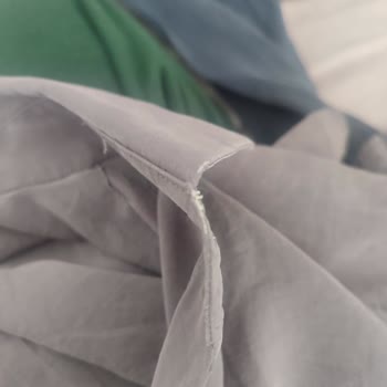 Paul Mark Gömleklerde Erken Deformasyon Ve Yetersiz İnceleme Süreci