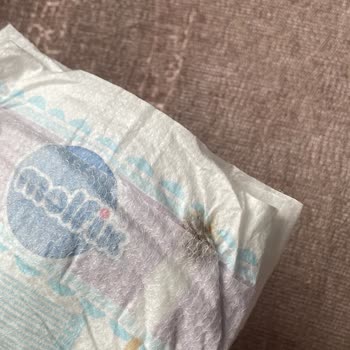 Aldığım Bebek Bezinde Leke Çıktı Güvenim Sarsıldı