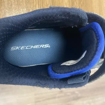 Kısa Sürede Deforme Olan Ayakkabıya Kullanıcı Hatası Denmesi Hayal Kırıklığı