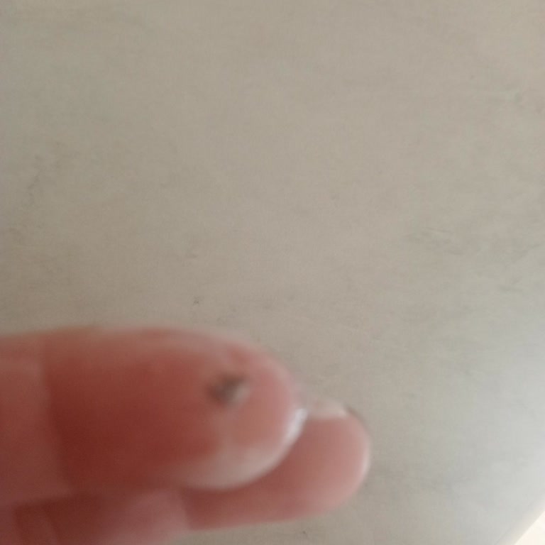 Peynir Paketinde Yabancı Madde Şoku: Hijyen Ve Sağlık Endişesi