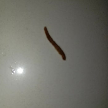 Cips Paketinden Çıkan Yabancı Maddeyle Yaşadığım Sağlık Endişesi