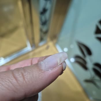 Kalıcı Oje Sonrası Tırnaklarım Zarar Gördü Çözüm Beklerken Mağdur Edildim