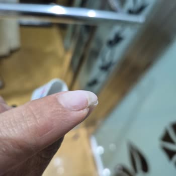 Kalıcı Oje Sonrası Tırnaklarım Zarar Gördü Çözüm Beklerken Mağdur Edildim