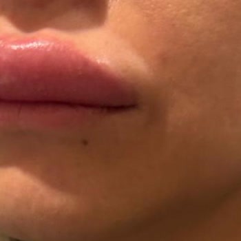 Elif Sayan Güzellik & Bakım İşlemler Sonrası Sağlık Sorunları Ve Mağduriyet!