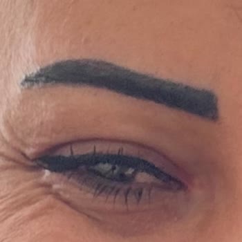 Kaş İşleminde Hatalı Uygulama Ve Mağduriyet