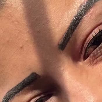 Kaş İşleminde Hatalı Uygulama Ve Mağduriyet