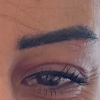 Kaş İşleminde Hatalı Uygulama Ve Mağduriyet