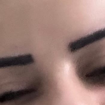 Kaş İşleminde Hatalı Uygulama Ve Mağduriyet