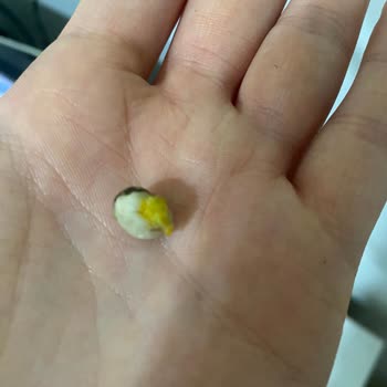 Aldığım Cips Fıstığın İçinden Taş Çıktı, Sağlık Ve Güvenlik Riski Yaşadım