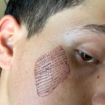 Yüz Ve Saç Tedavilerinde Sonuç Alamadım Mağduriyetim Arttı