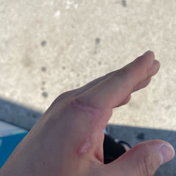 Yüz Ve Saç Tedavilerinde Sonuç Alamadım Mağduriyetim Arttı