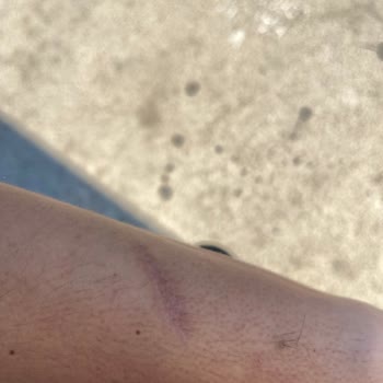 Yüz Ve Saç Tedavilerinde Sonuç Alamadım Mağduriyetim Arttı