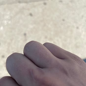 Yüz Ve Saç Tedavilerinde Sonuç Alamadım Mağduriyetim Arttı