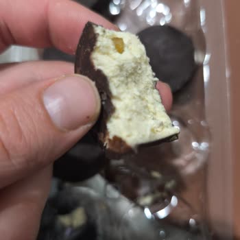 Pişmaniyeden Cam Parçası Çıktı, Sağlığım Tehlikeye Girdi!