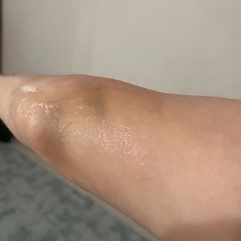 Hastanede İlgisiz Doktor Ve Dikkatsiz Hemşire Deneyimi