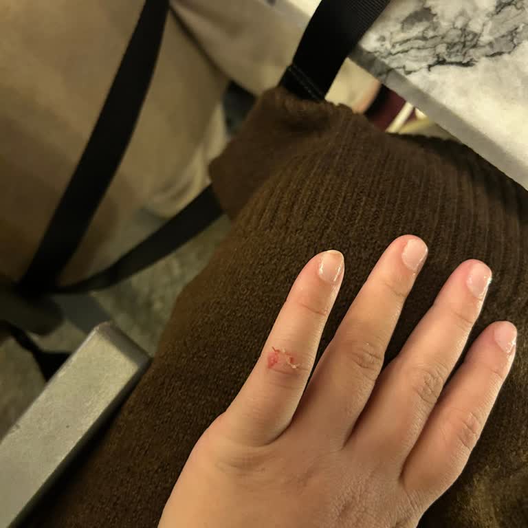 Hamamda Personel Saygısızlığı Ve Hijyen Sorunları Nedeniyle Mağduriyet