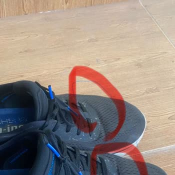 Kısa Sürede Deforme Olan Ayakkabıya Olumsuz Müşteri Hizmeti