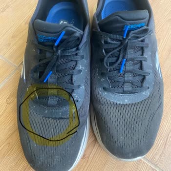 Kısa Sürede Deforme Olan Ayakkabıya Olumsuz Müşteri Hizmeti