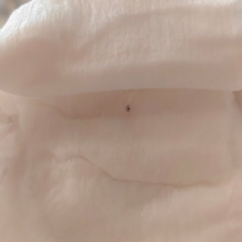 Bebek Bezinde Taş Benzeri Sert Cisimle Karşılaşmak Güvenimi Sarsıyor